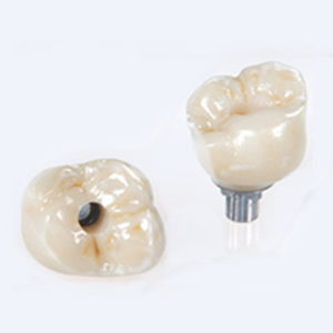 Metal Implant Porcelain