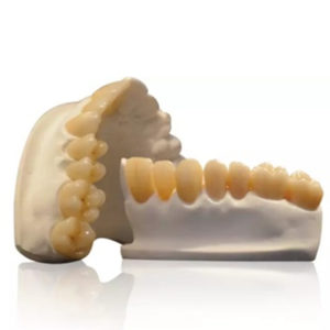 Ultra-Translucent Zirconia